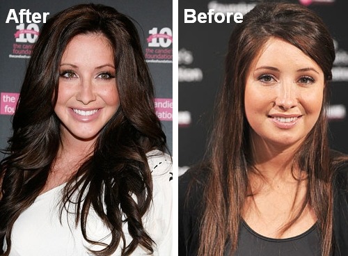 미국에서 은근히 많이하는 성형수술 세가지 | 인스티즈