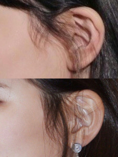 [소녀시대외] 수지 귀&태연 손으로 보는 다이어트 효과 | 인스티즈