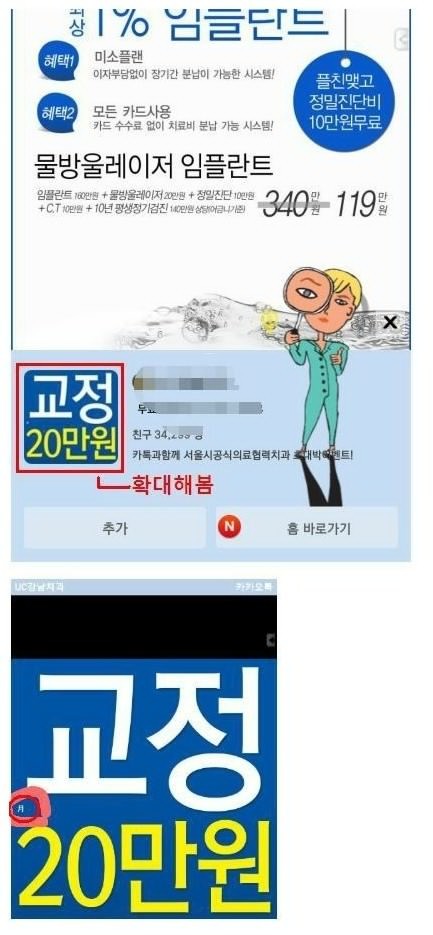 어이없는 치과광고 | 인스티즈