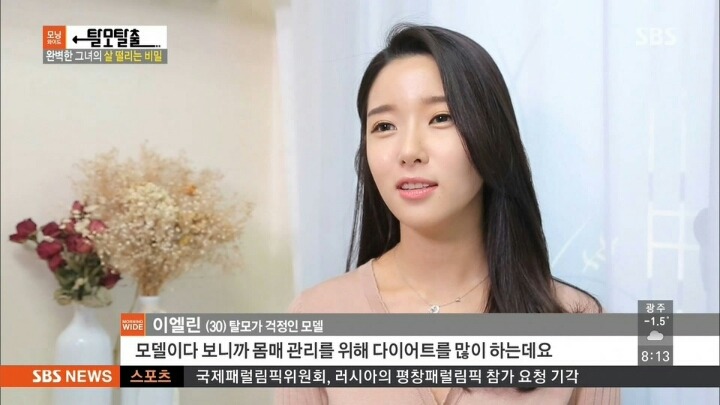 탈모가 고민인 여성 모델 | 인스티즈