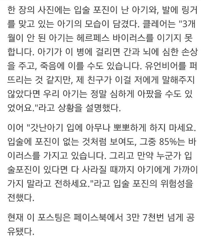 갓난아기에게 함부로 뽀뽀하면 안 되는 이유 | 인스티즈