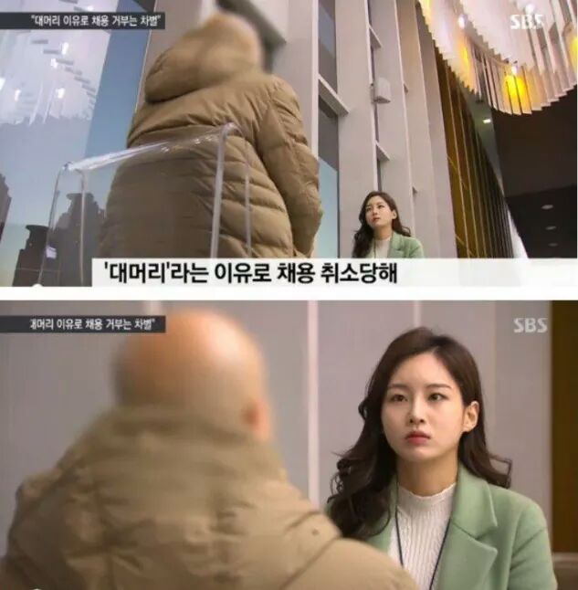 대머리라는 이유로...jpg | 인스티즈