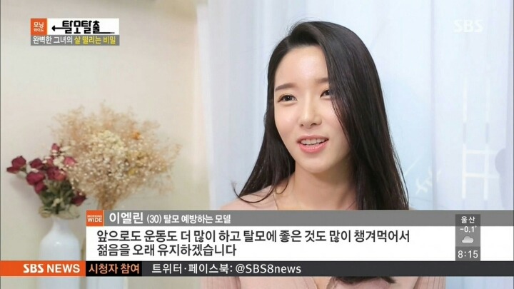 탈모가 고민인 여성 모델 | 인스티즈
