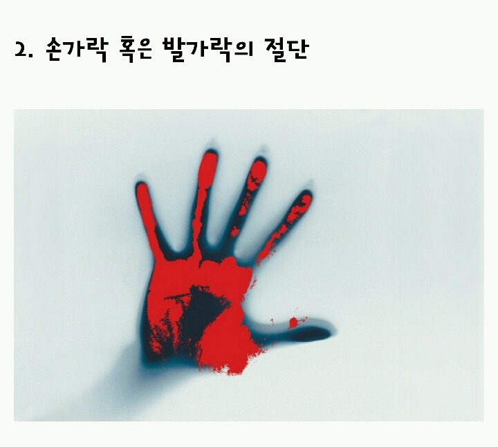 인간이 느낄 수 있는 가장 강력한 통증 순위 | 인스티즈