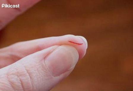 실수로 겪게 되는 고통 중 가장 싫은 고통은???? | 인스티즈
