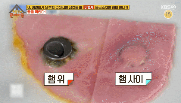 아이들이 단추형 건전지를 삼킬경우 크게 위험한 이유 | 인스티즈
